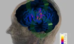 A computer generated model of a brain inside a person's head. 