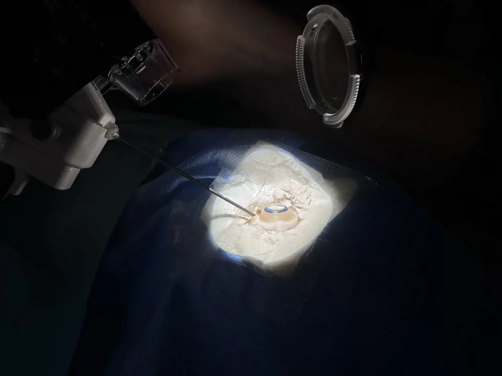 A model of the eye in which the surgical robot is being tested