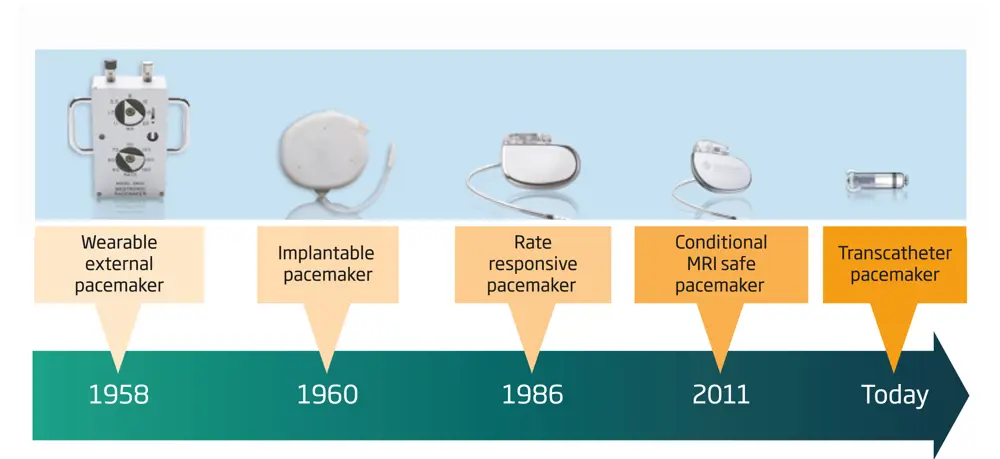 A schematic showing the evolution of cardiac pacemakers, from the wearable external pacemaker in 1958, to the transcatheter pacemaker used today.