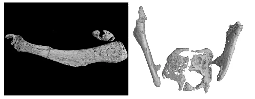 Close-ups of bones with cracking damages.