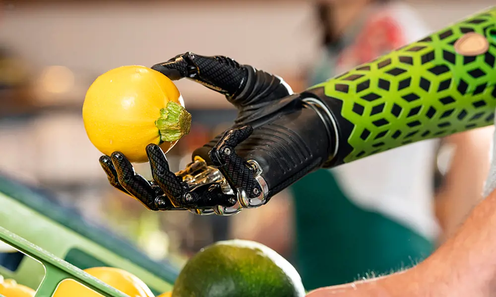 Someone wearing a prosthetic arm with a green pattern, holding a round yellow courgette in the fingertips