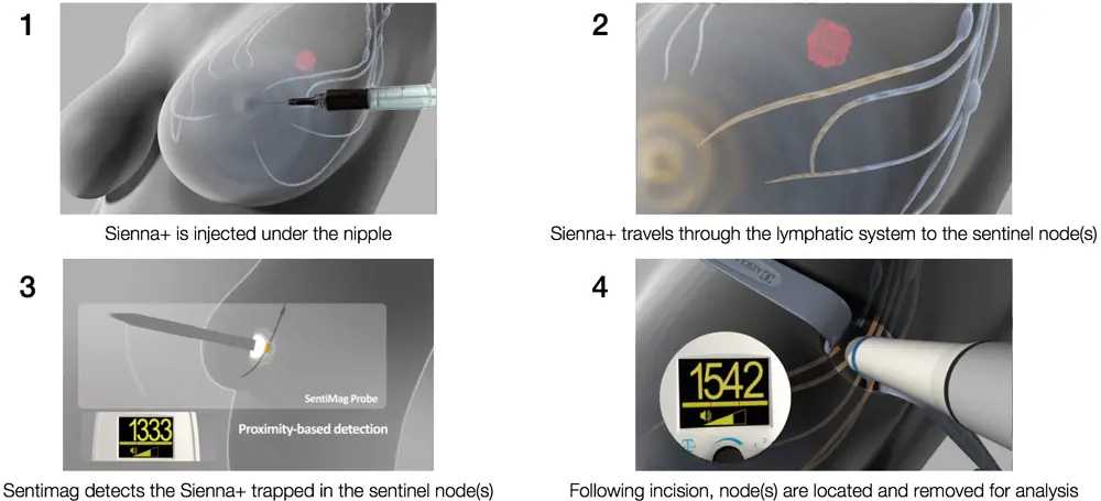 An illustration of how the Sienna+ is injected into a patient and the Sentimag can then detect the Sienna+.