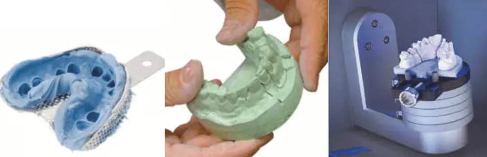 A dental impression from someone's mouth (left). A study model made of gypsum plaster (middle). A study model on a platform to be scanned and digitised (right).