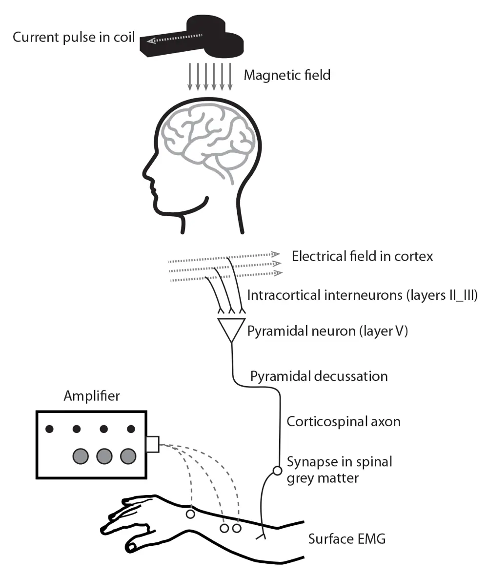A diagram of the magnetic stimulation pathway. 