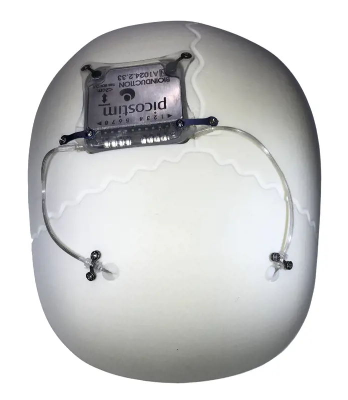 The anchor plate, electrode lead and Picostim device, that form part of the Picostim Brain Stimulator system, which can be mounted on the skull.