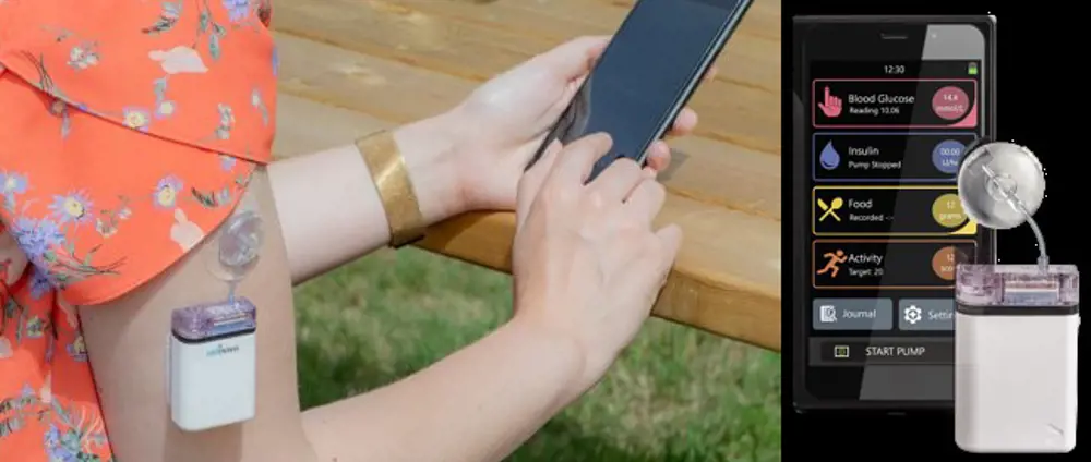 A rectangular-shaped device that measures insulin attached to someone's bicep who is looking at their phone to display the reading (left). A smartphone screen for the insulin pump showing blood glucose readings, insulin levels, food and activity (right).