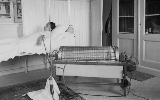 A greyscale image of a women lying on a bed, with her arm outstretched, connected to the first artificial kidney machine. 